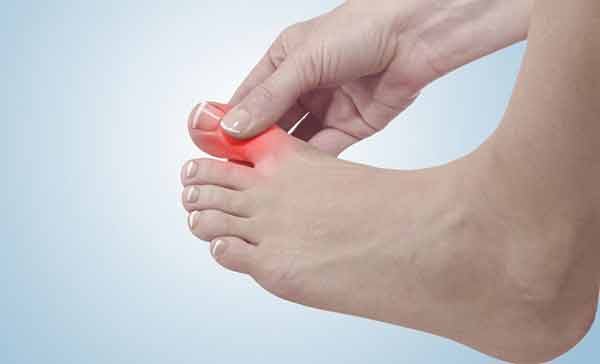 top 5 homoeopathic medicine for heel pain