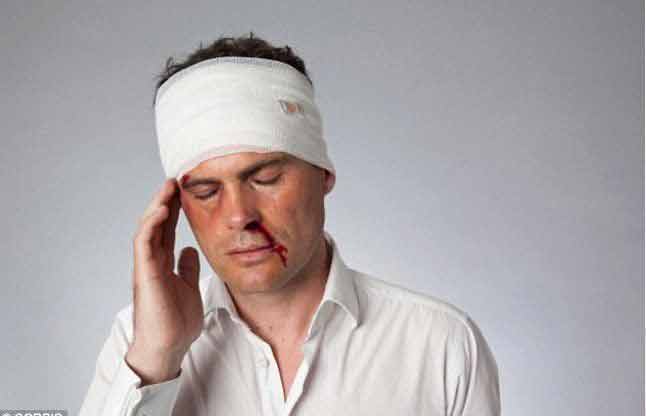 Head Injuries Archives Homeopathy At DrHomeo