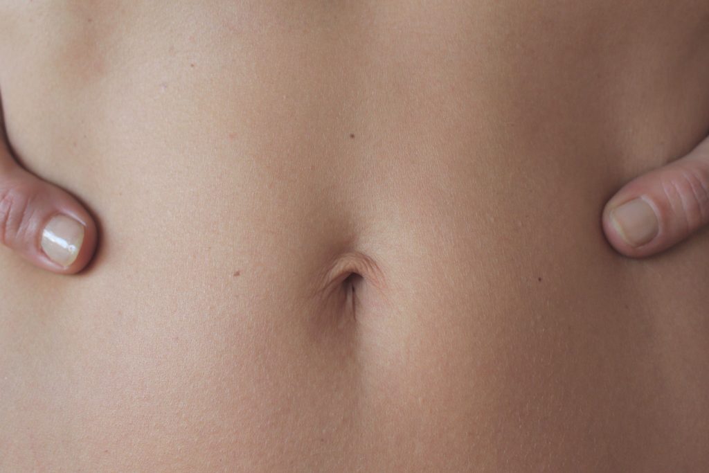 Child Rash Around Belly Button